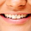 Titanium Smiley Piercing Ball Hoop Ring for Lip Frenulum - 18G 16G 14G Captive Bead Ring Also Piercing for Septum Ring, Nipple Ring, Daith